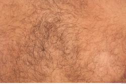 Hairy Skins